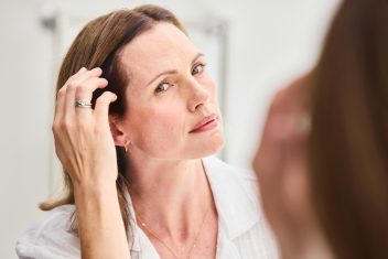 How to Approach Hair Loss with a Client